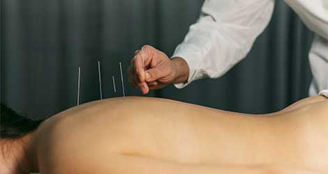 Acupuncture vs. Chiropractic Care: Which is Right for You?